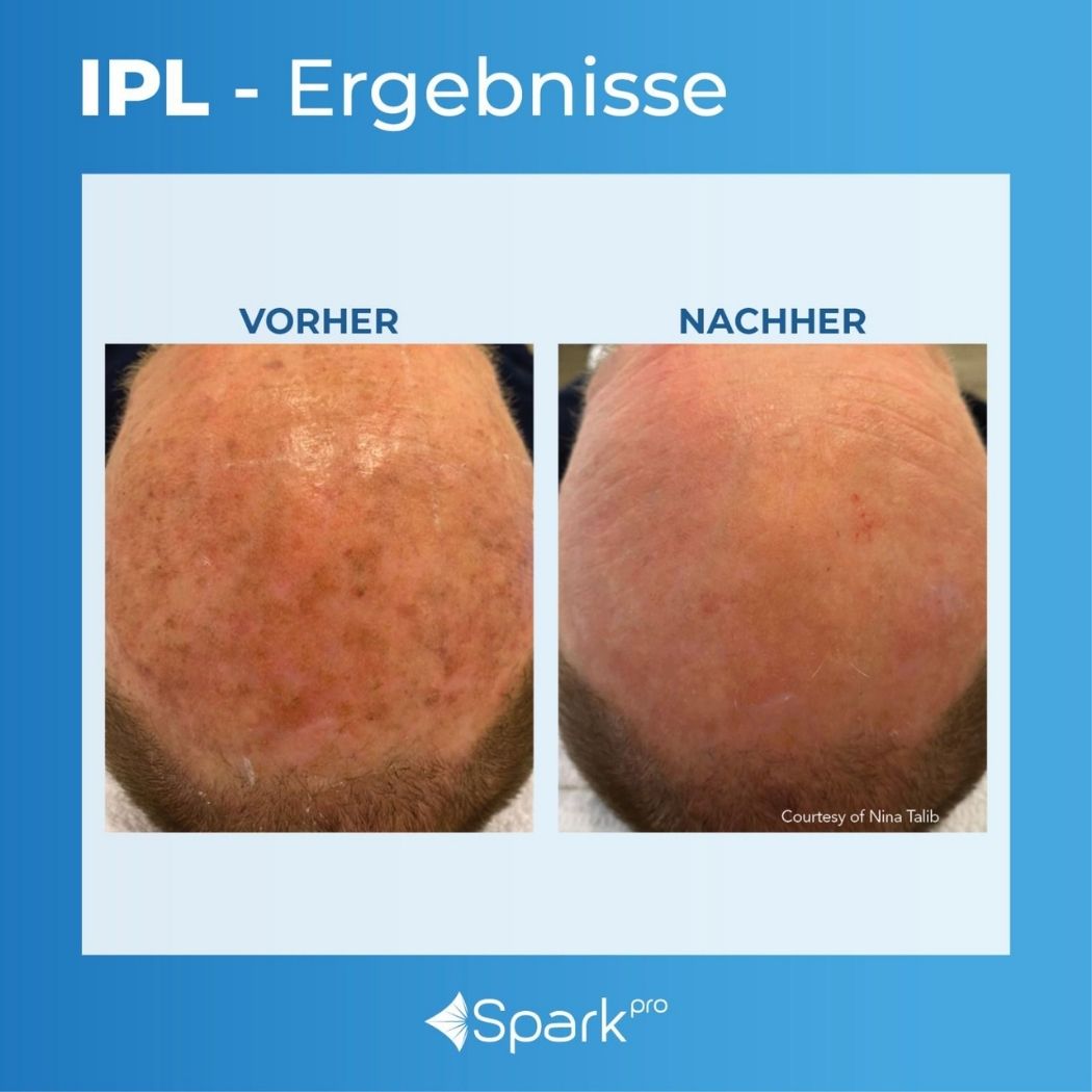 Untitled design - 2026-02-28T013200.854