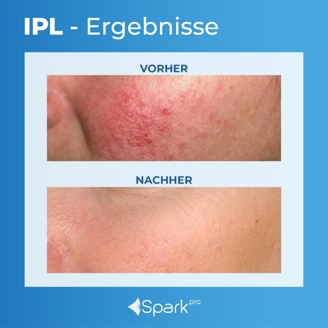 Untitled design - 2026-02-28T013209.989