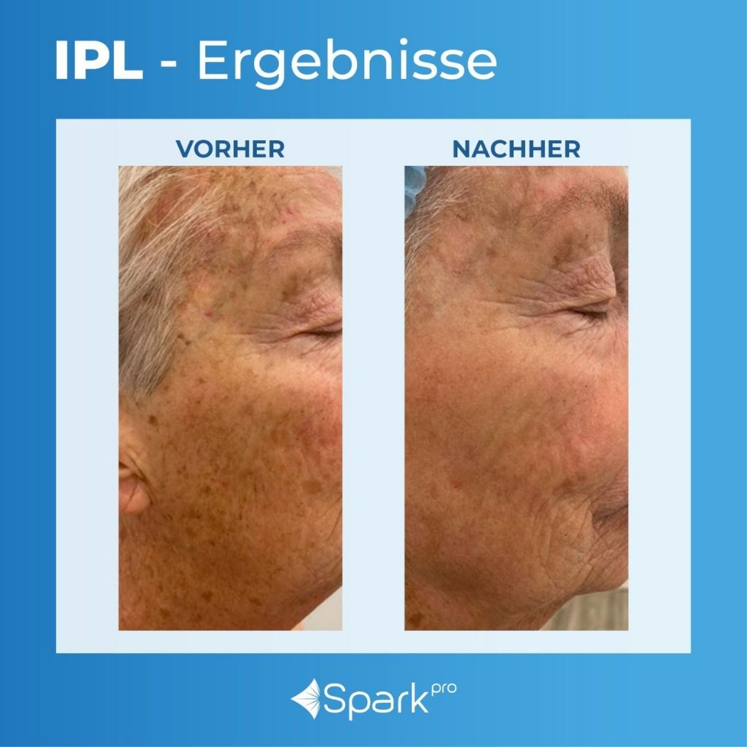 Untitled design - 2026-02-28T013220.166