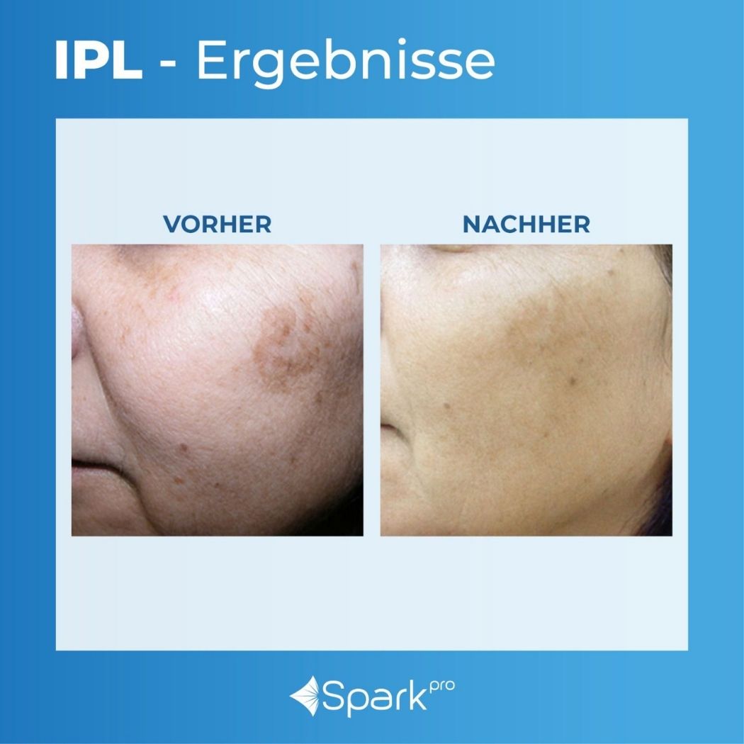 Untitled design - 2026-02-28T013228.578